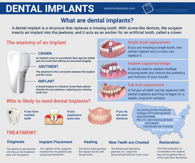 Dental Implants Astoria, Queens, NY Best Implant Dentists
