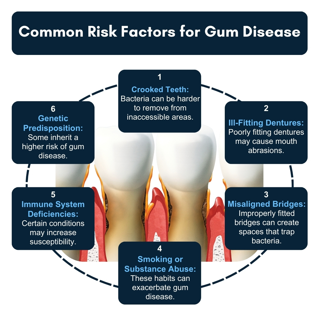 Common Risk Factors For Gum Disease