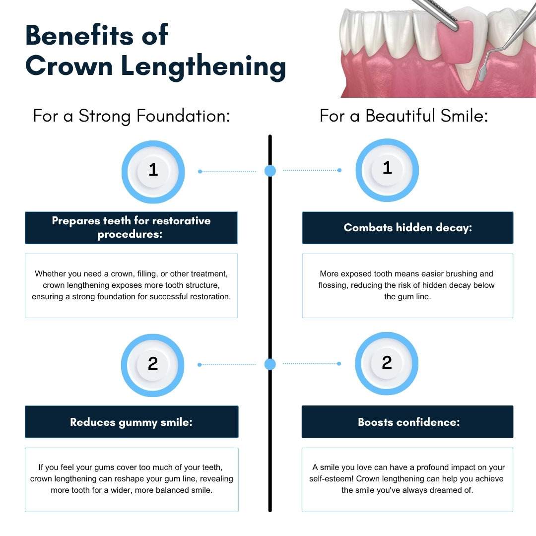 Benefits of Crown Lengthening